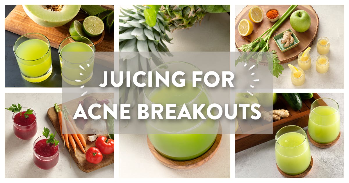 Best juice for on sale acne